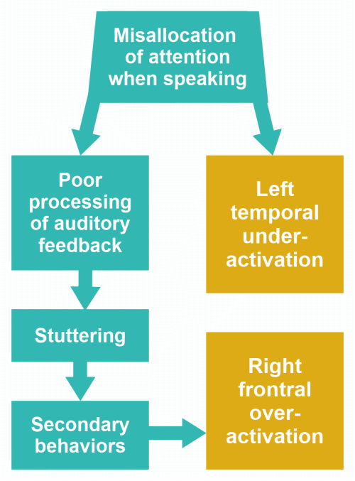 Theory of stuttering: lateralization of speech processing